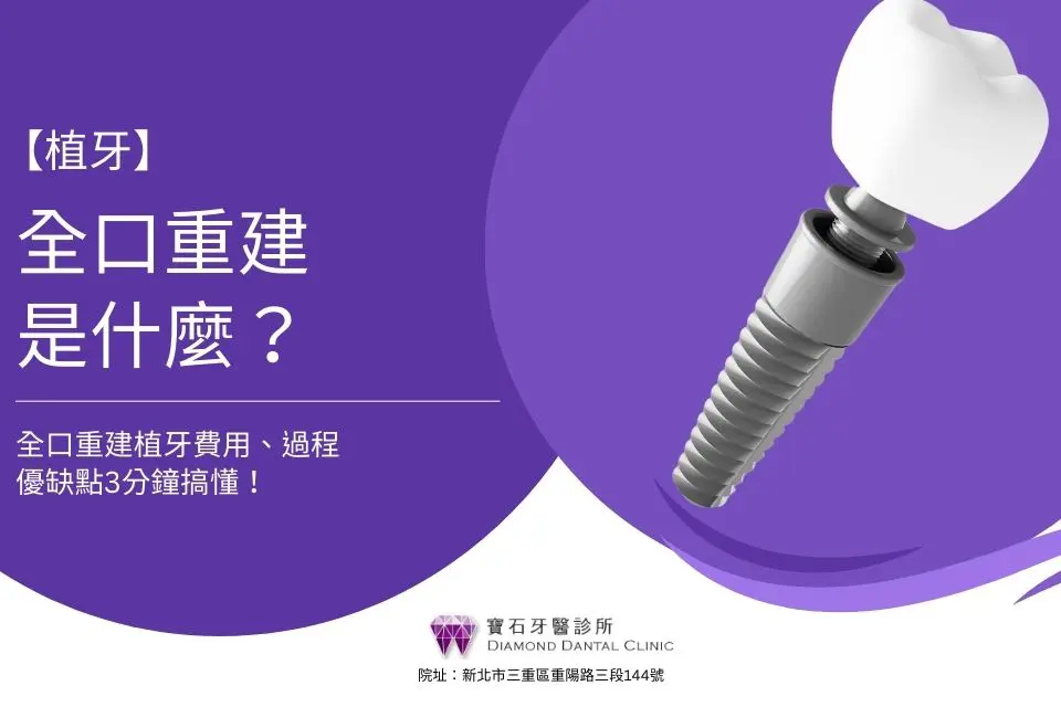 全口重建是什麼?全口重建植牙費用、過程、優缺點3分鐘搞懂!