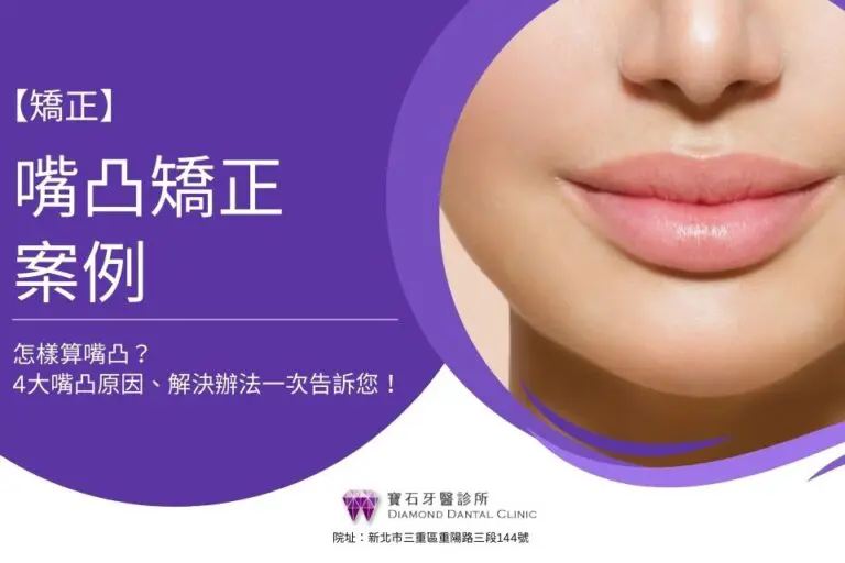 【嘴凸矯正案例分享】怎樣算嘴凸？4大嘴凸原因、解決辦法一次告訴您！