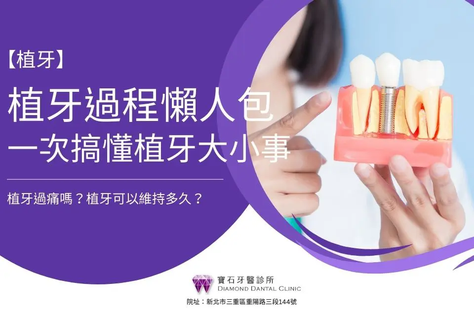 「植牙過程圖解」植牙流程要多久?植牙過程會痛嗎?