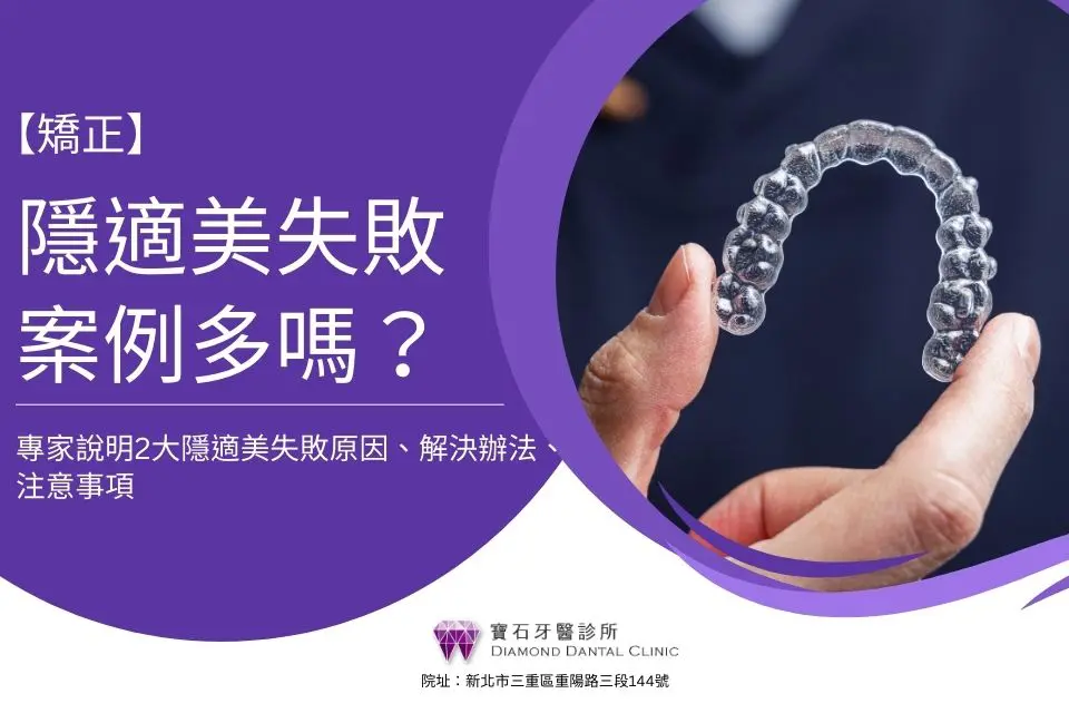 隱適美失敗案例多嗎?專家說明2大隱適美失敗原因、解決辦法、注意事項