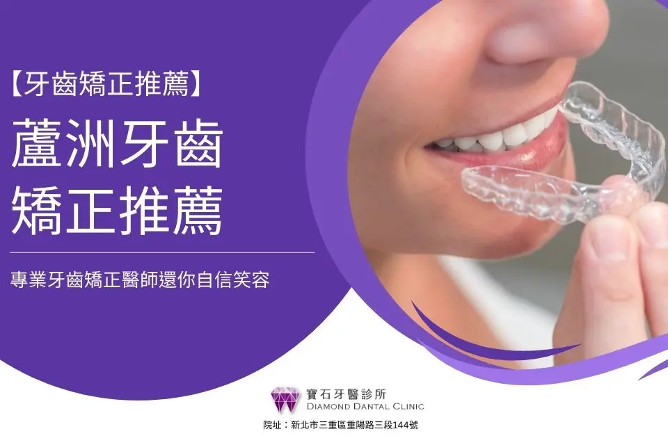 蘆洲牙齒矯正推薦|蘆洲矯正Dcard都推「它」!專業牙齒矯正醫師還你自信笑容
