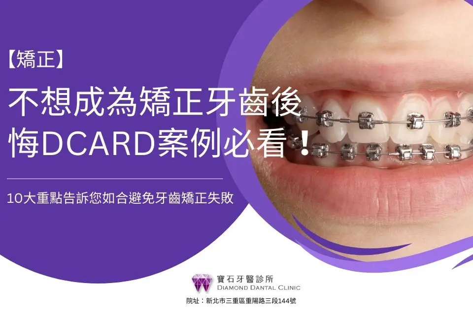 不想成為矯正牙齒後悔Dcard案例必看!10大重點告訴您如合避免牙齒矯正失敗