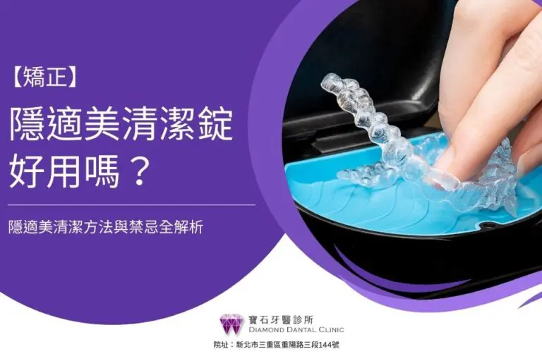 隱適美清潔Dcard都在問!隱適美清潔錠好用嗎?隱適美清潔方法與禁忌全解析