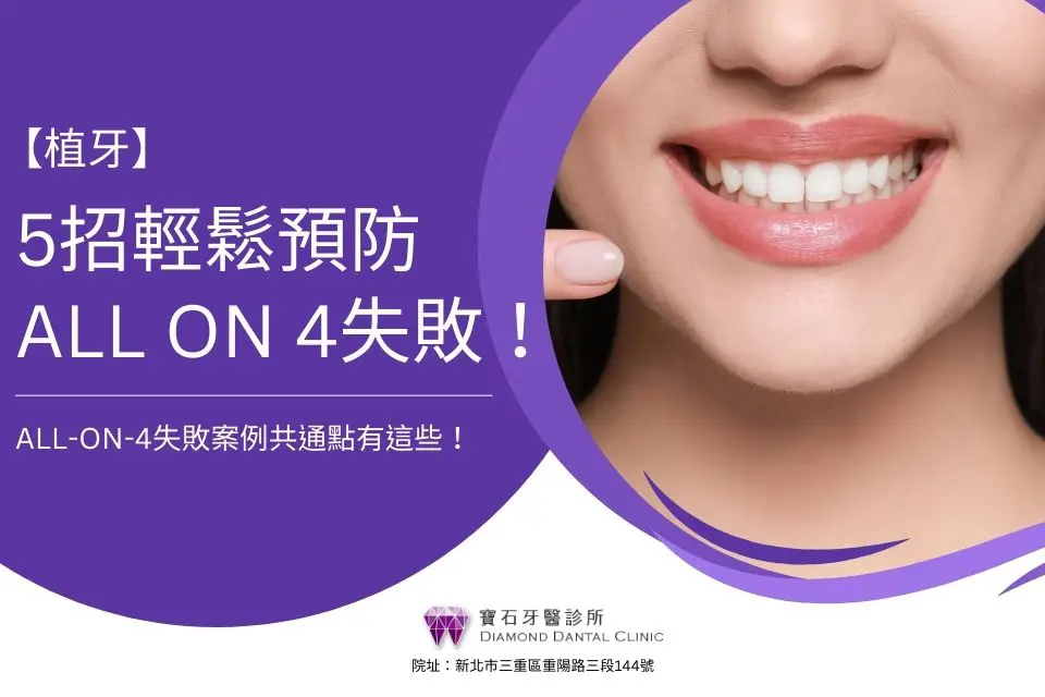 All-on-4失敗案例共通點有這些!5招教你輕鬆預防All on 4失敗!