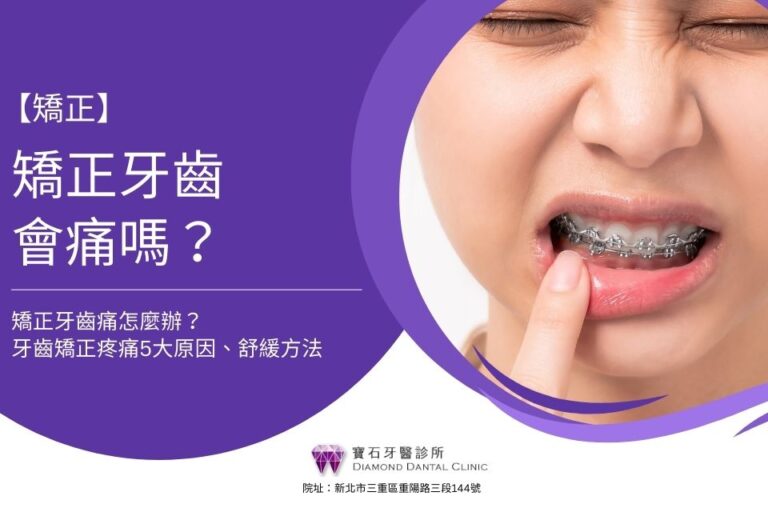 矯正牙齒會痛嗎?矯正牙齒痛怎麼辦?牙齒矯正疼痛5大原因、舒緩方法,本篇有解!
