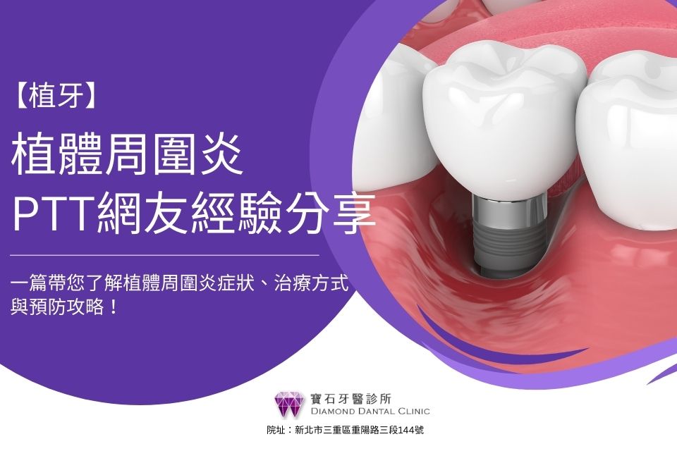 植體周圍炎ptt網友經驗分享|一篇帶您了解植體周圍炎症狀、治療方式與預防攻略!
