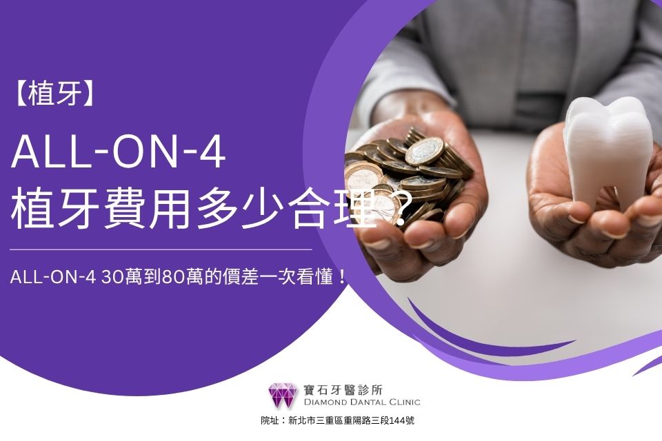 All-on-4植牙費用多少合理？All-on-4 30萬到80萬的價差一次看懂！