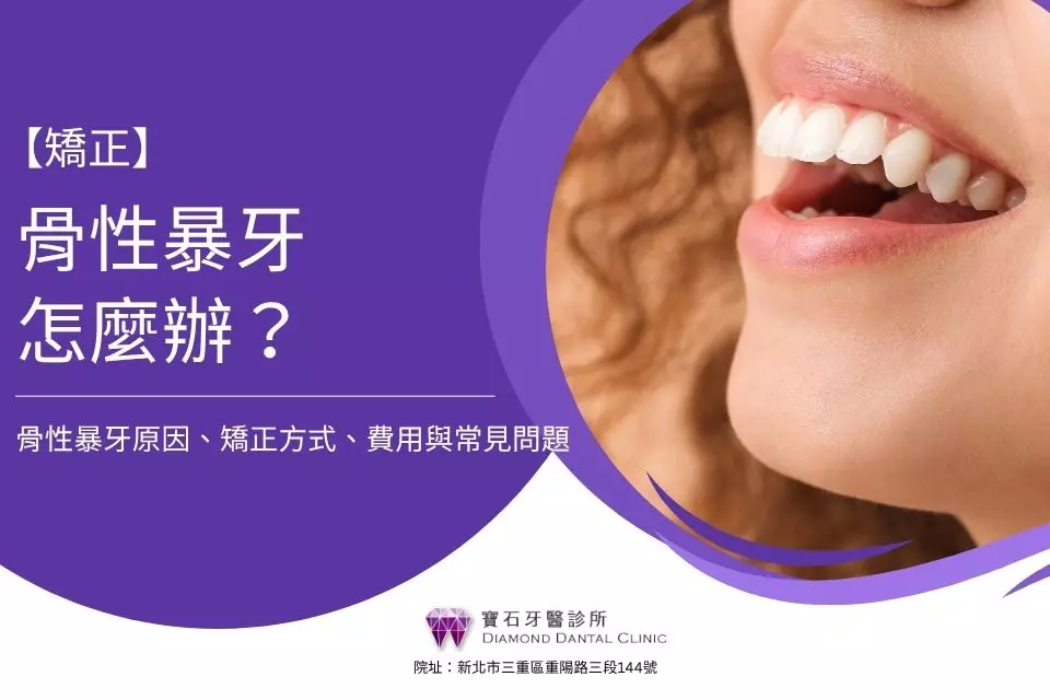 骨暴矯正Dcard熱議:骨性暴牙怎麼辦?骨性暴牙原因、矯正方式、費用與常見問題