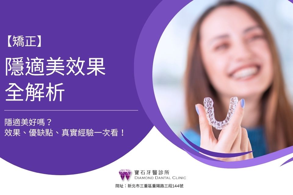 隱適美效果全解析:隱適美好嗎?效果、優缺點、真實經驗一次看!