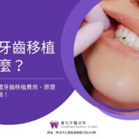 自體牙齒移植是什麼？牙醫解析自體牙齒移植費用、原理，優缺點全攻略！