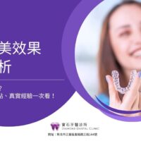 隱適美效果全解析：隱適美好嗎？效果、優缺點、真實經驗一次看！