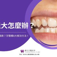 gap-between-teeth1