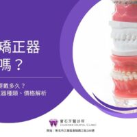 牙齒矯正器有用嗎？牙齒矯正器要戴多久？4大牙齒矯正器種類、價格解析