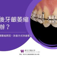 矯正後牙齦萎縮怎麼辦？牙齒矯正牙齦萎縮原因、改善方式快速看！